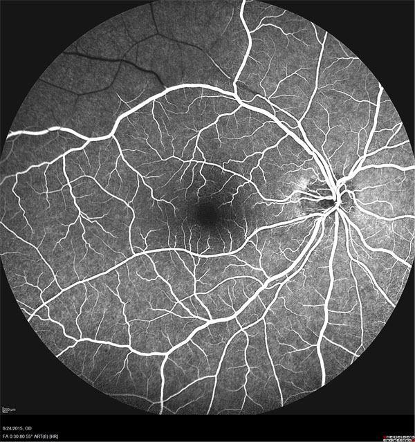 Retina and Uveitis Center